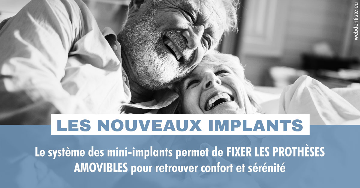 https://www.abcd-dentiste.fr/Les nouveaux implants 2