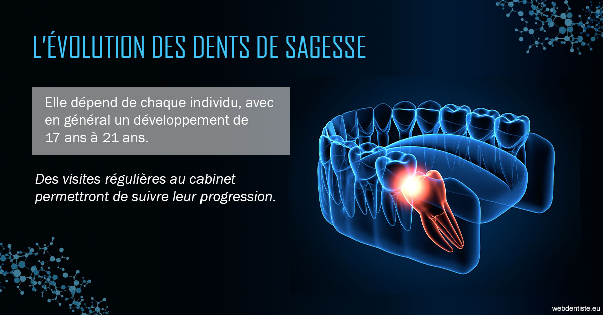 https://www.abcd-dentiste.fr/2023 T4 - Dents de sagesse 01