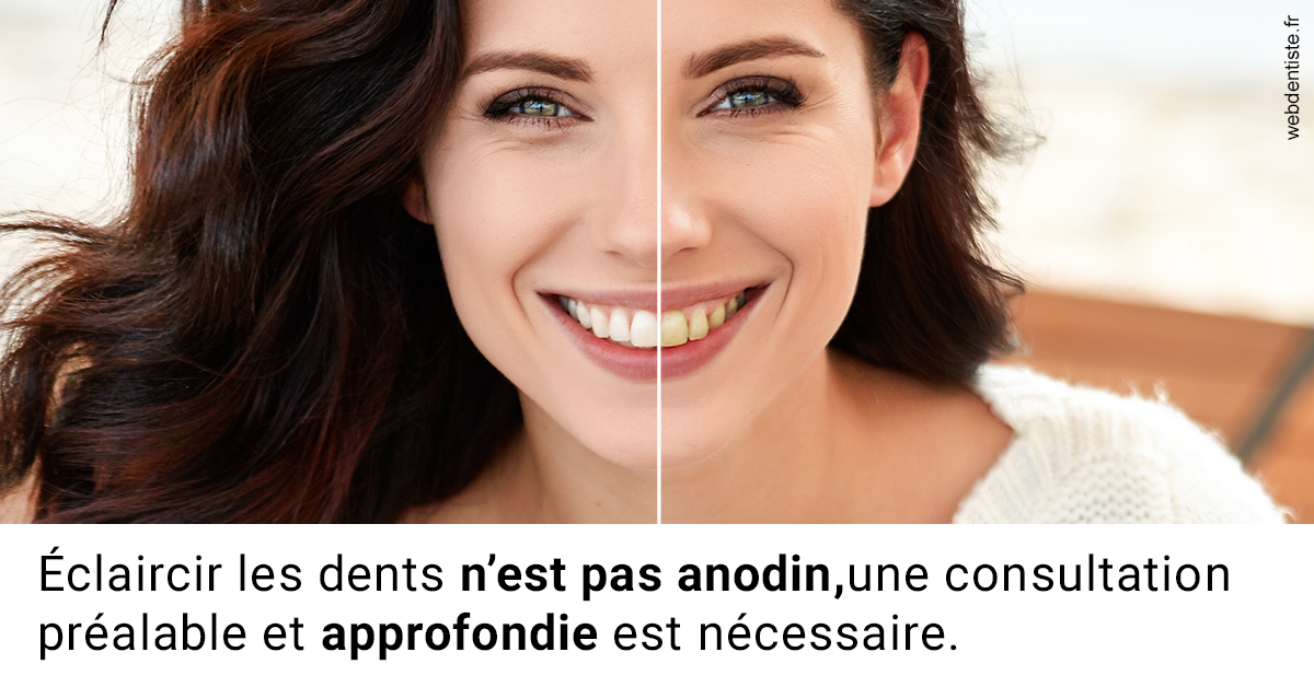 https://www.abcd-dentiste.fr/Le blanchiment 2