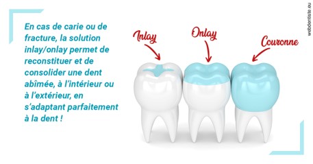 https://www.abcd-dentiste.fr/L'INLAY ou l'ONLAY