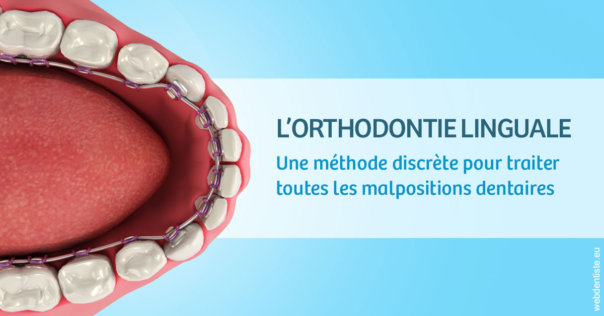 https://www.abcd-dentiste.fr/L'orthodontie linguale 1