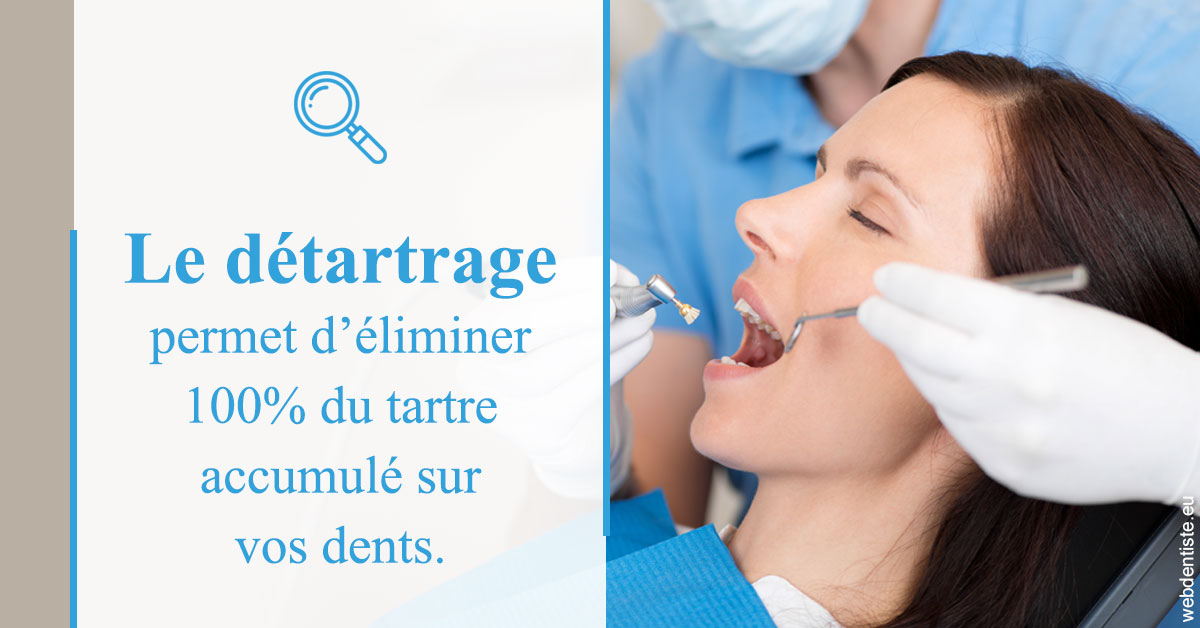 https://www.abcd-dentiste.fr/En quoi consiste le détartrage