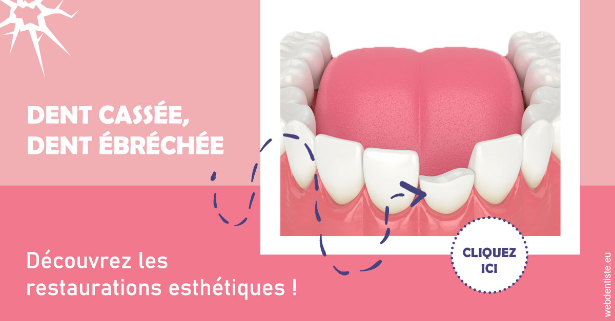 https://www.abcd-dentiste.fr/Dent cassée ébréchée 1