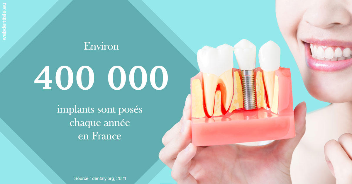 https://www.abcd-dentiste.fr/Pose d'implants en France 2