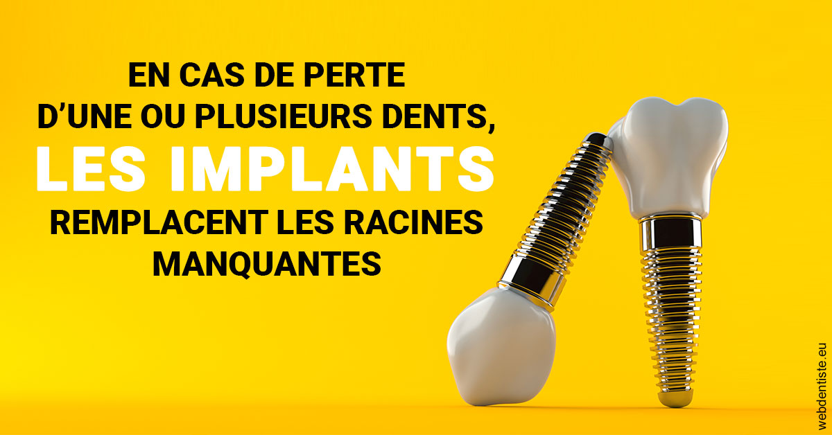 https://www.abcd-dentiste.fr/Les implants 2