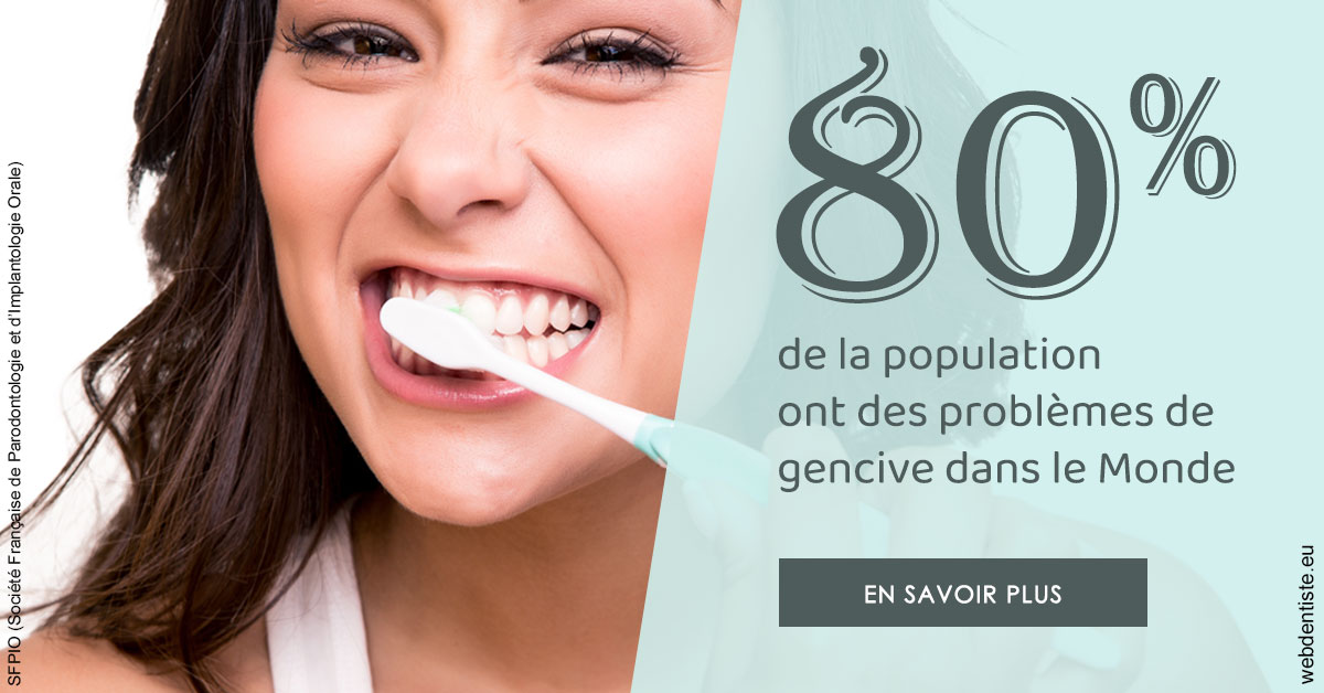 https://www.abcd-dentiste.fr/Problèmes de gencive 1